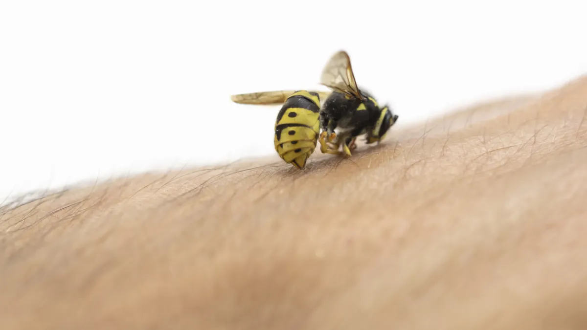 piqûre d'abeille