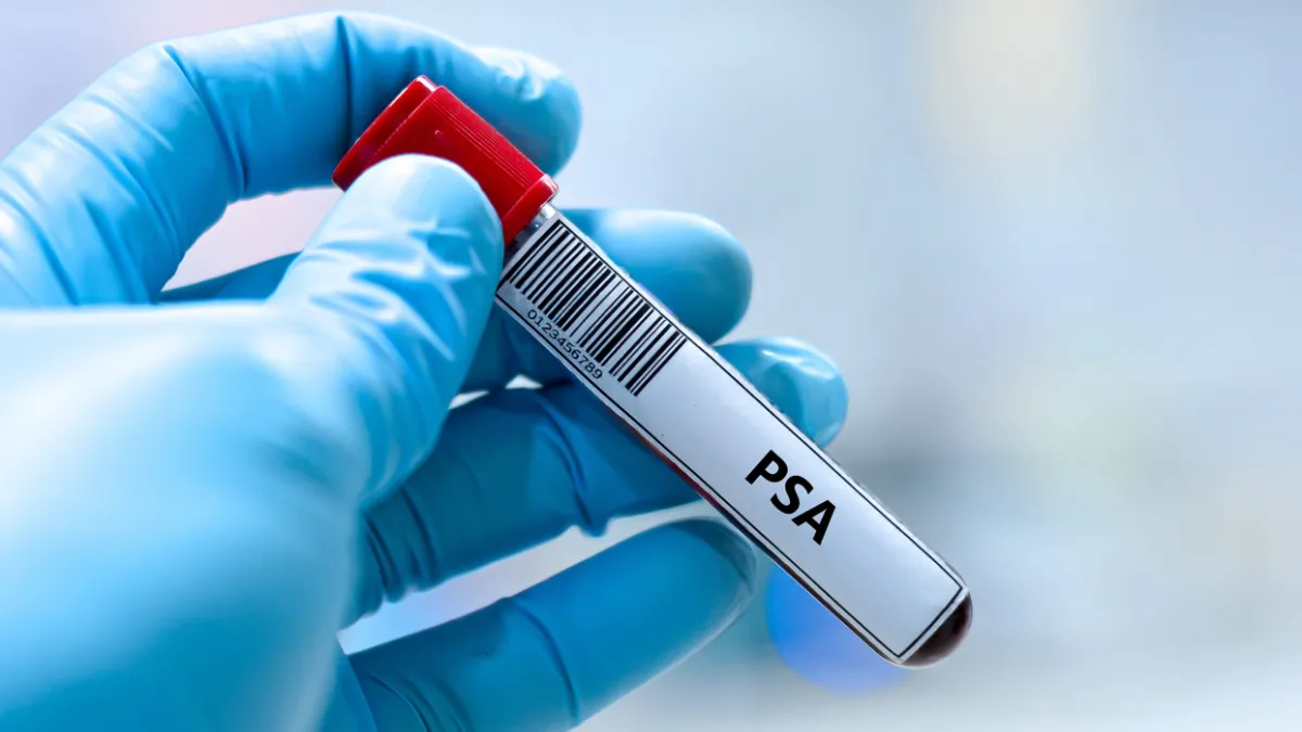dosage de PSA