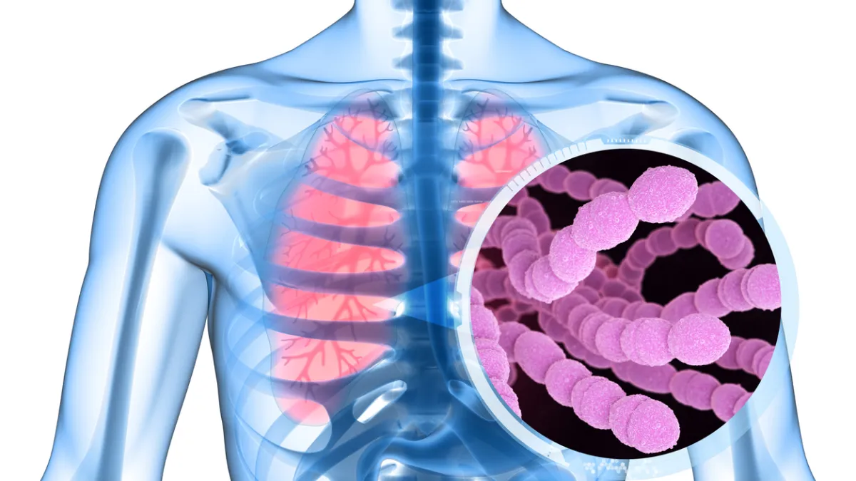 infection à pneumocoque dans les poumons
