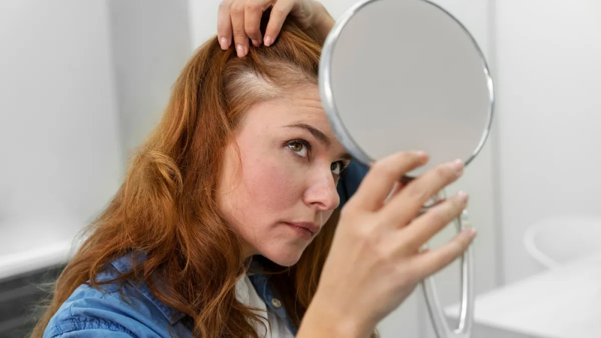 perte cheveux