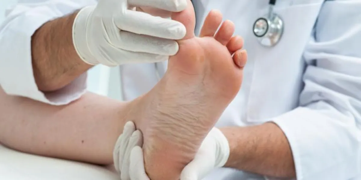 médecin dermatologue examine le pied sur la présence du pied de l'athlète