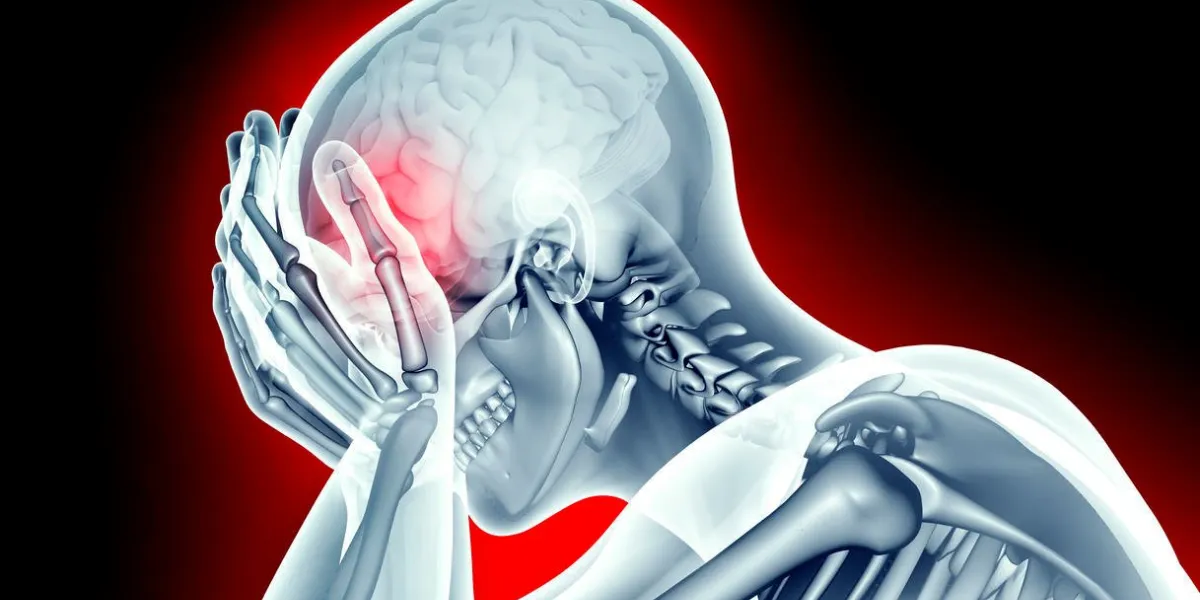 image radiographique tête humaine avec douleur de mal de tête