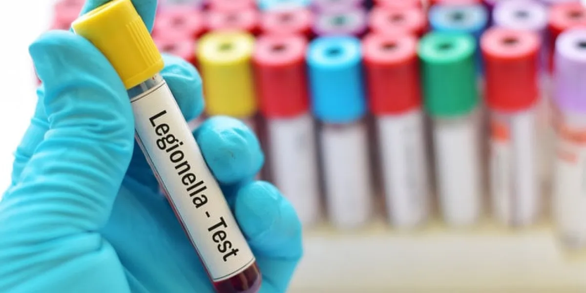 blood sample for legionella test