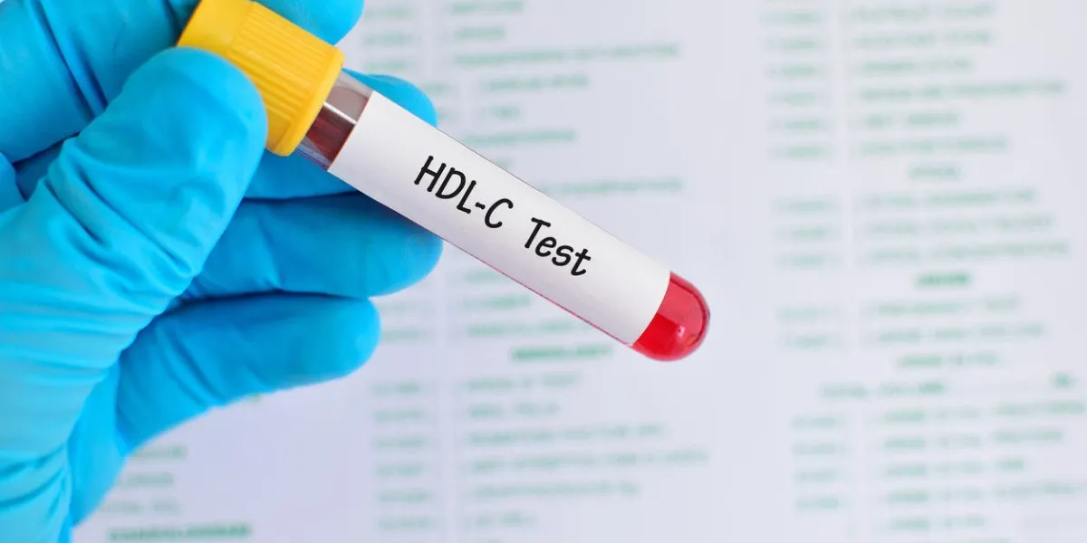 échantillon de sang pour le test hdl-cholestérol