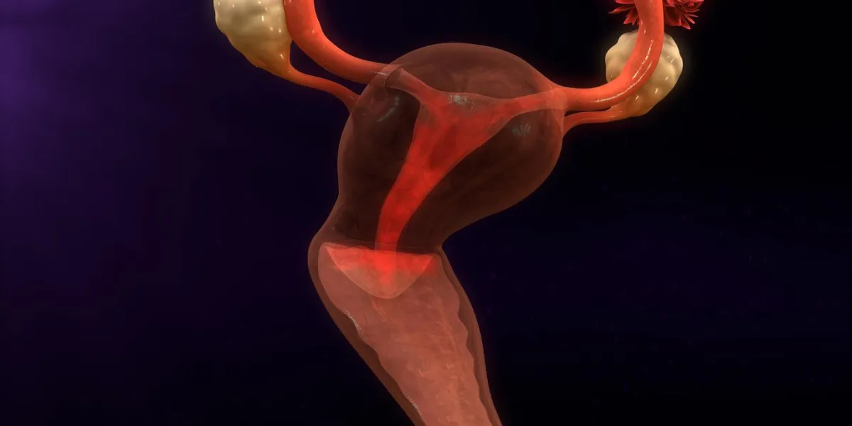 la menstruation, également connue sous le nom de période ou mensuelle, est la décharge régulière de sang et de tissu muqueux de la paroi interne de l'utérus à travers le vagin