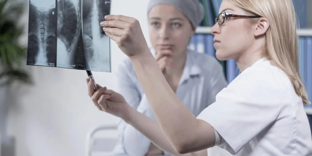 jeune médecin en regardant la photo xray de son patient