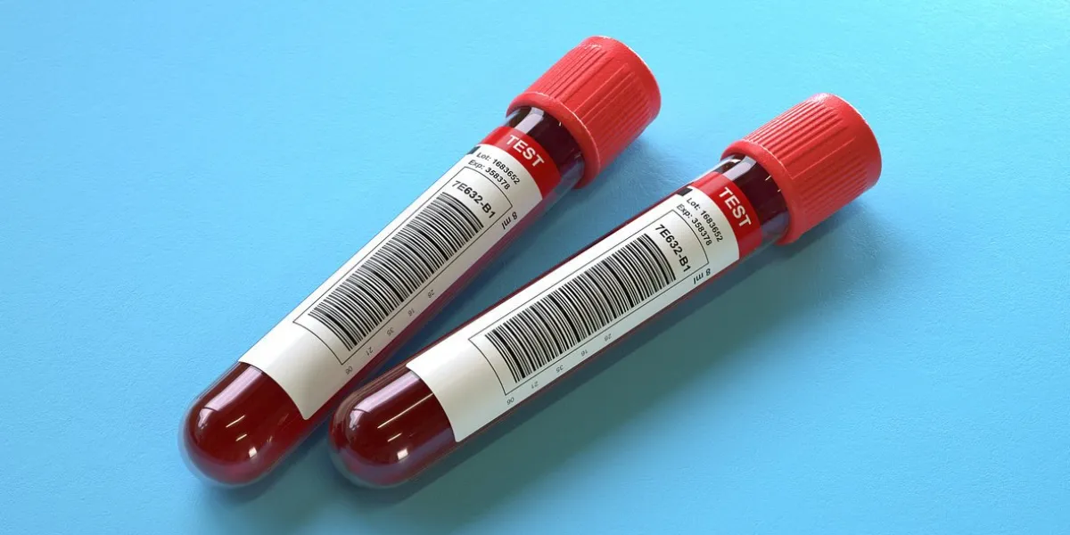 blood test tubes in the lab,blood samples,3d rendering,conceptual image