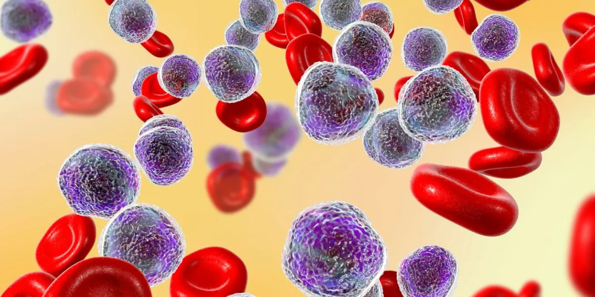 acute lymphoblastic leukemia, bone marrow smear, 3d illustration