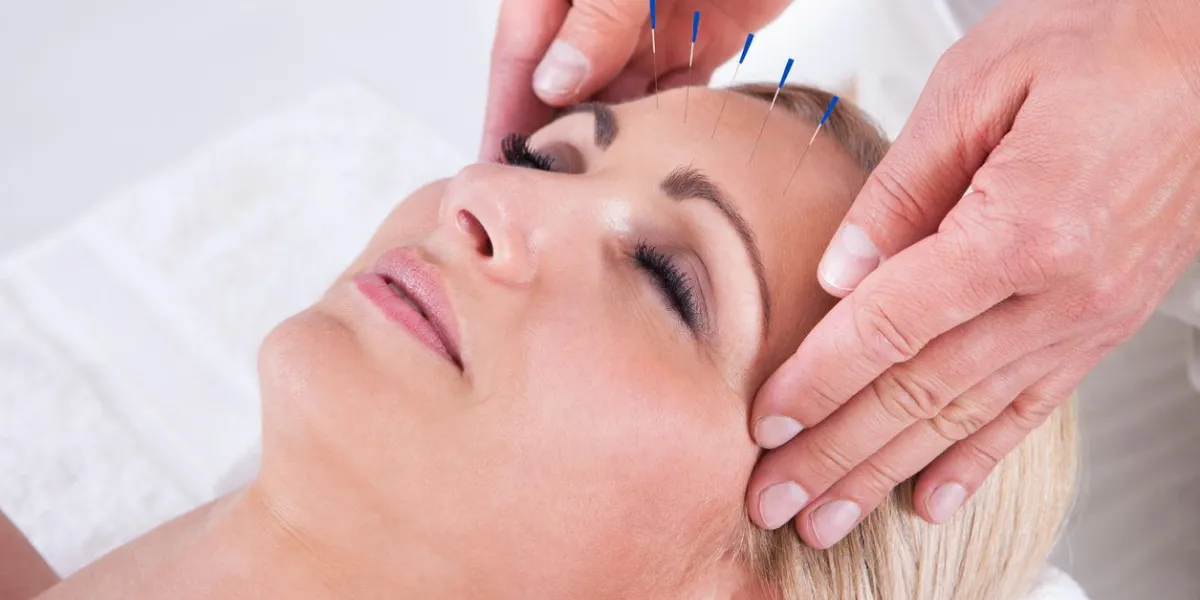 détail d'une femme recevant une thérapie d'acupuncture à l'aiguille