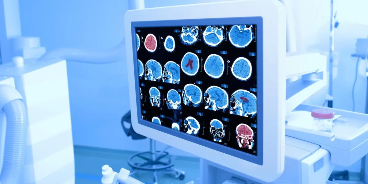 moniteur de rayons x dans la chambre d'hôpital