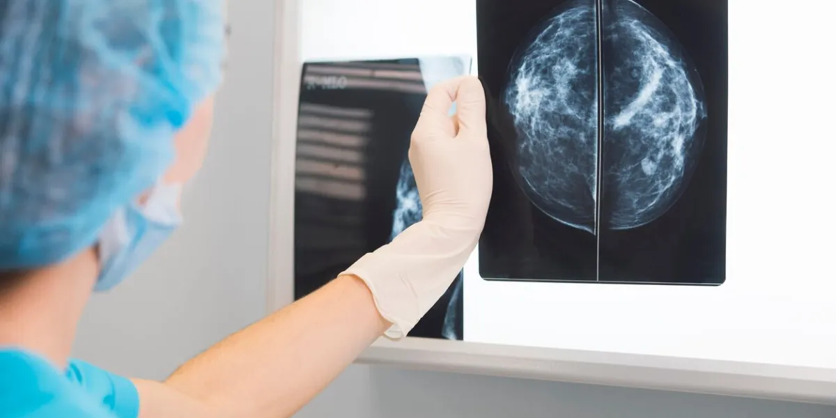woman doctor or nurse in surgery outfit is holding a mammogram in front of x-ray illuminator