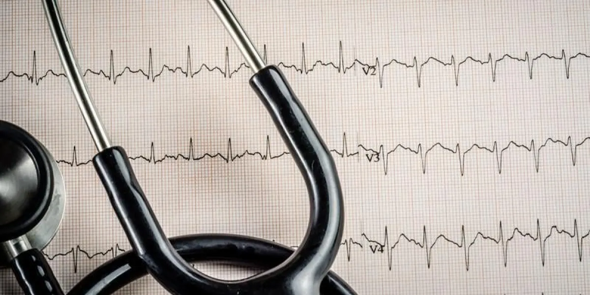 examen médical, électrocardiogramme, médecine cardiaque et thérapie