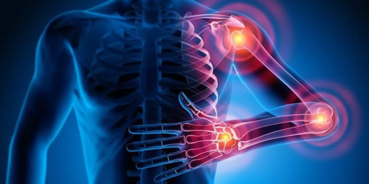 points de douleur rhumatismale