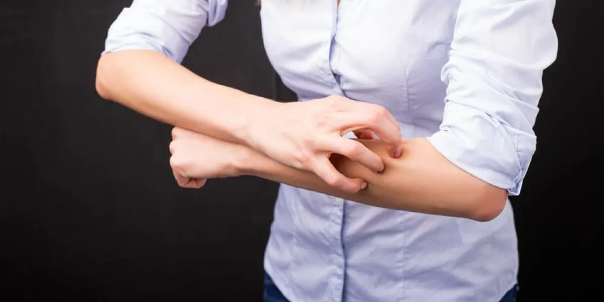 femme ayant une réaction allergique