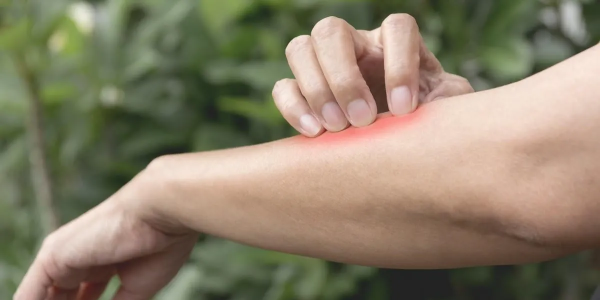 women scratch itch with hand woman scratching her arm healthcare concept