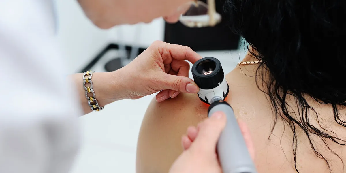 doctor examining birthmarks and moles patient examination of birthmarks and molesthe doctor examines the patient's mole