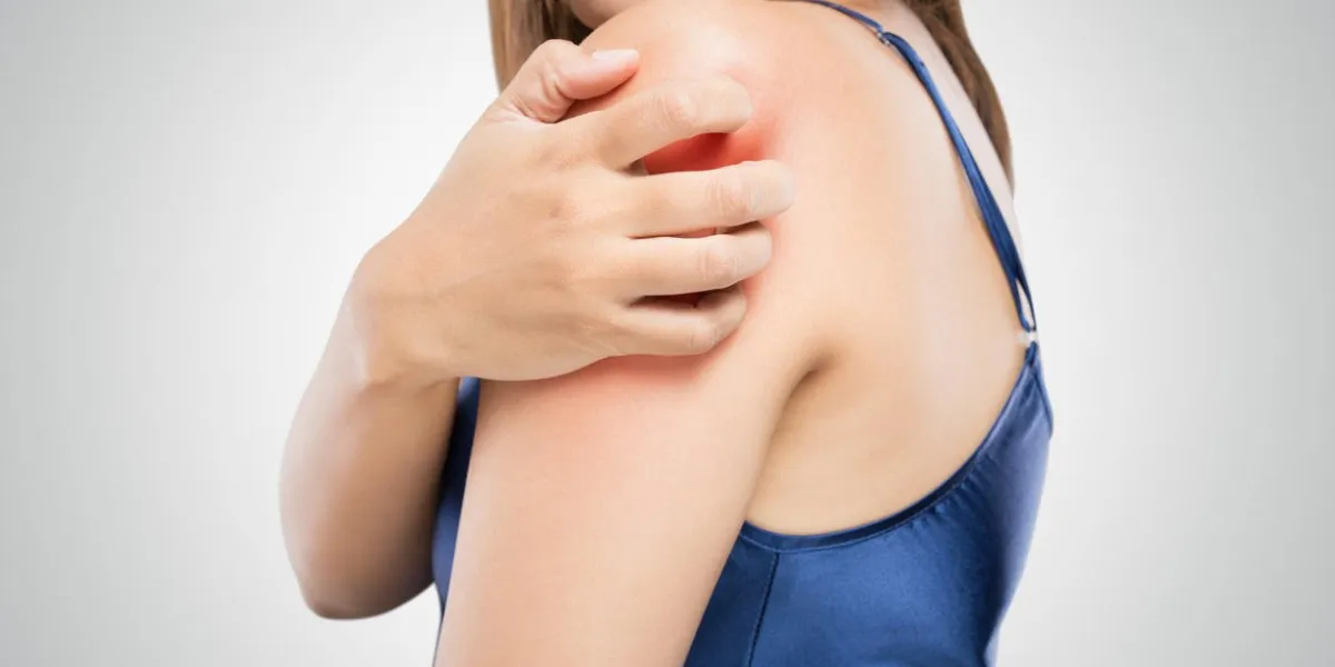 les gens grattent la démangeaison avec la main, le bras, les démangeaisons, les soins de santé et la médecine, la belle femme avec le concept de problème de peau