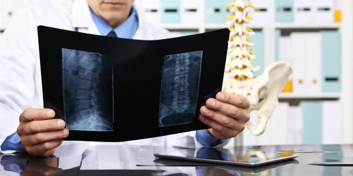 radiologue, docteur, vérification, xray, healthcare, médical, et, radiologie, concept