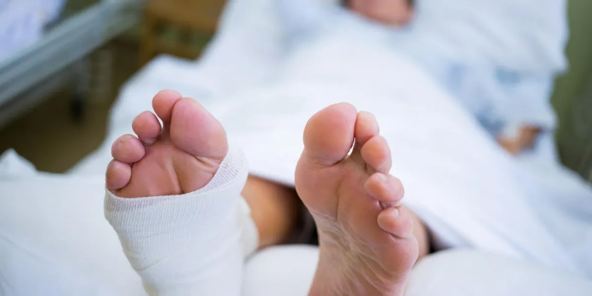 patient avec une jambe cassée dans un plâtre dans un lit d'hôpital