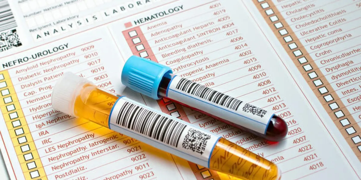 deux tubes étiquetés avec des codes à barres, chaque échantillon d'urine et un avec du sang sur un rapport médical pour une analyse de routine