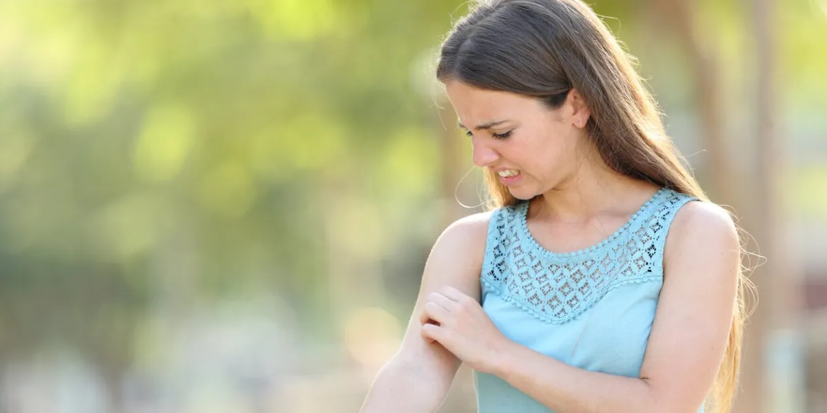 woman scratching arm because it stings