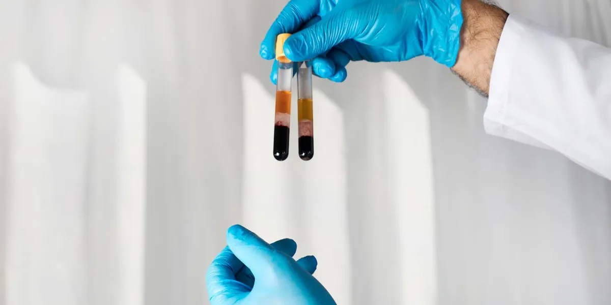 blood tube for testing in laboratory