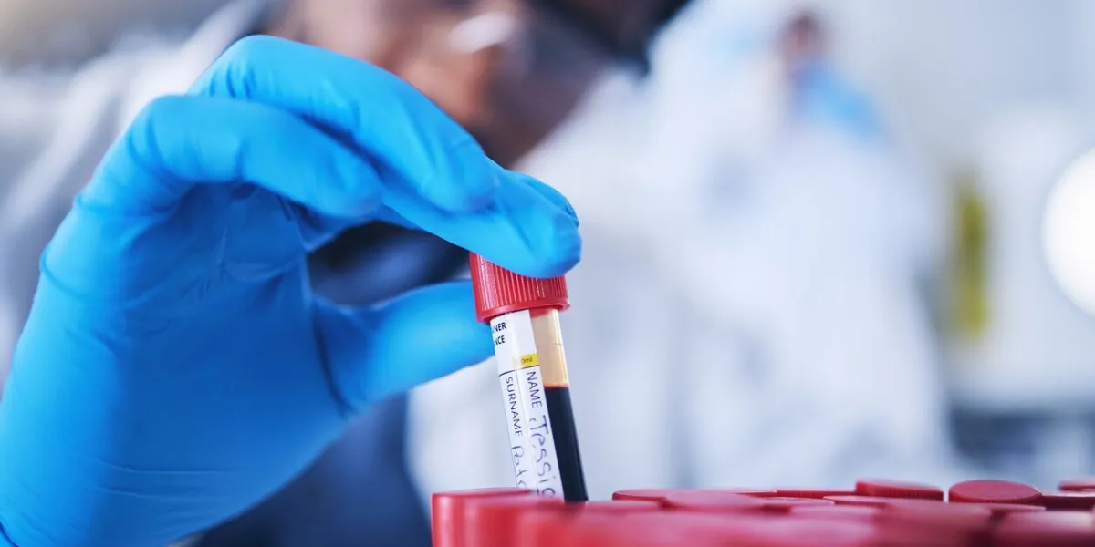 science, blood and hands with test tube in laboratory for research, medical exam and sample analysis healthcare, pharmaceutical and black man scientist with vial for dna experiment, rna and genetics