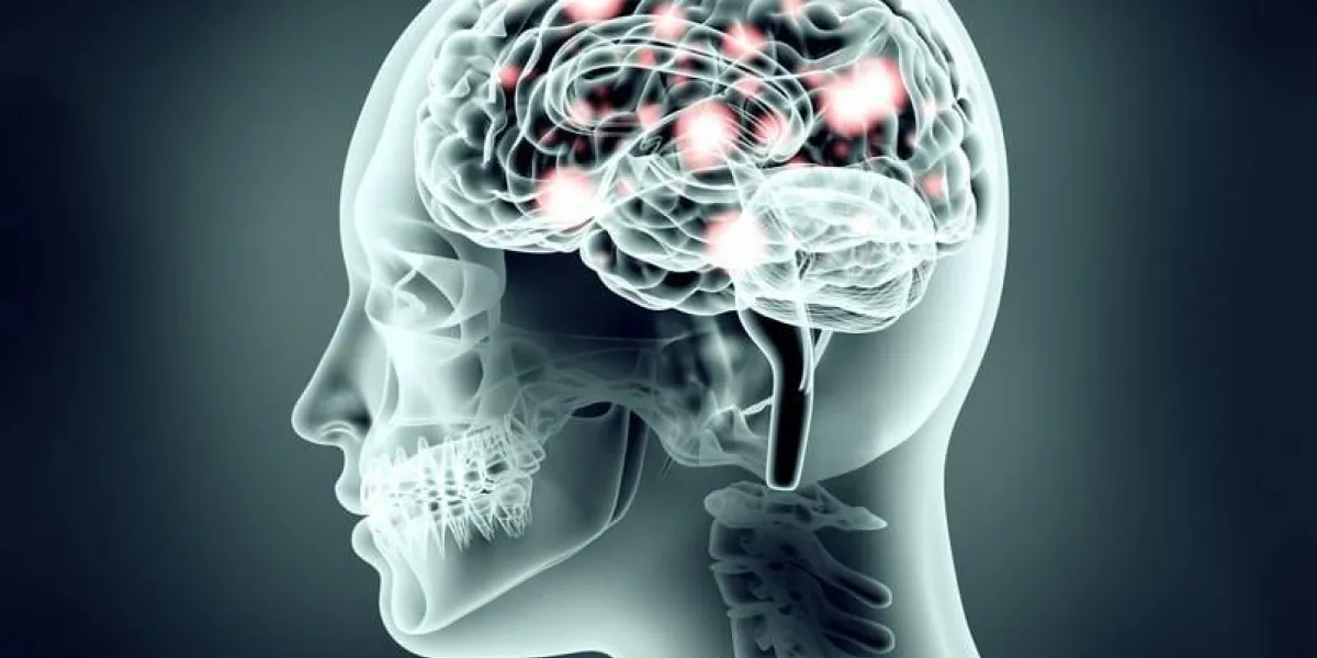 image de radiographie de la tête humaine avec des impulsions cérébrales et électriques