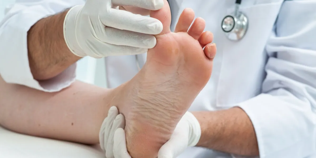 doctor dermatologist examines the foot on the presence of athlete''s foot