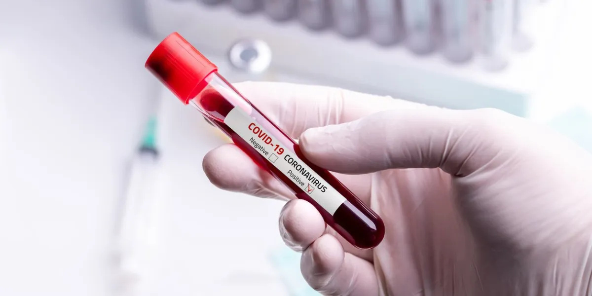 doctor wearing medical gloves holding a blood tube with positive coronavirus 2019-ncov blood sample