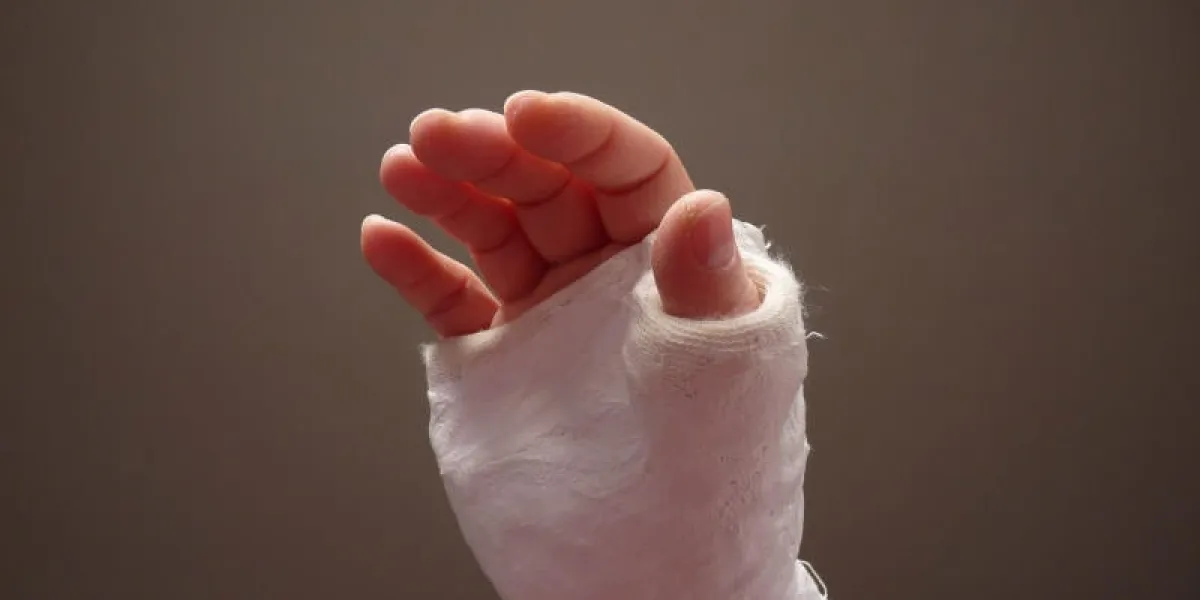 main blessée avec moulage sur fond sombre