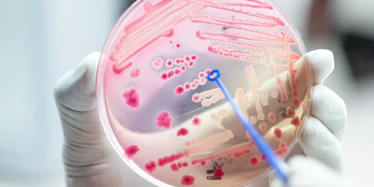 escherichai coli colonies of pink bacteria ferment lactose culture on macconkey agar in microbiology department hospital