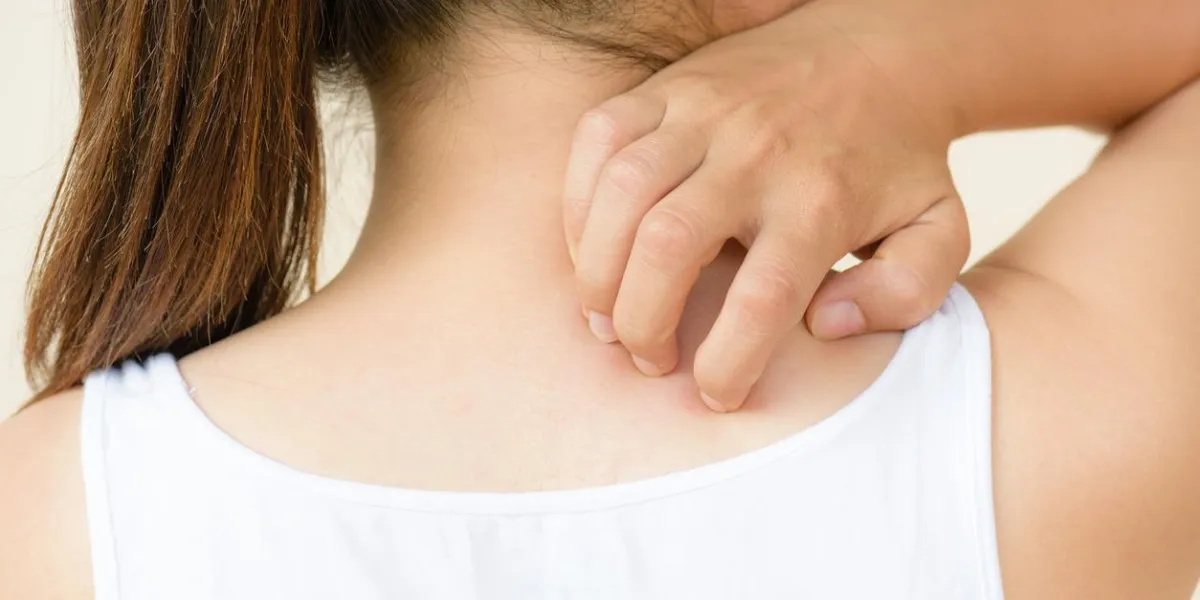 close up woman hand scratch the itch by hand at neck and back healthcare and medical concept