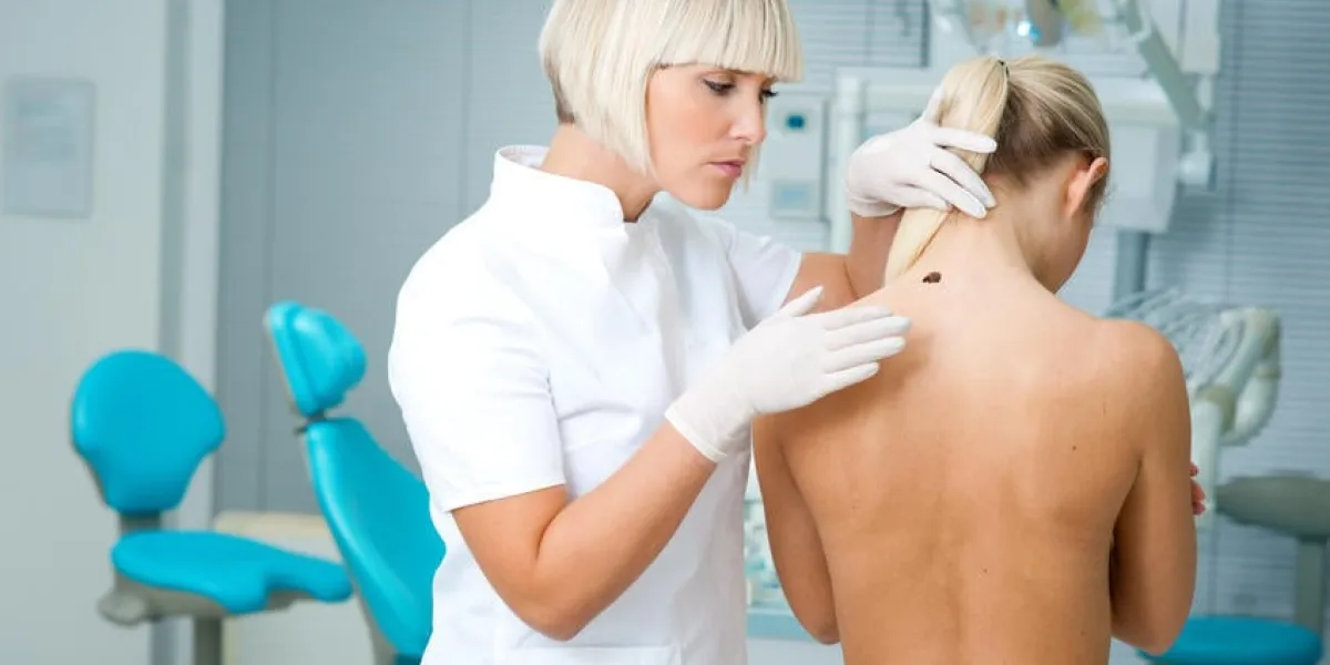 médecin examinant la peau de la femme pour le mélanome