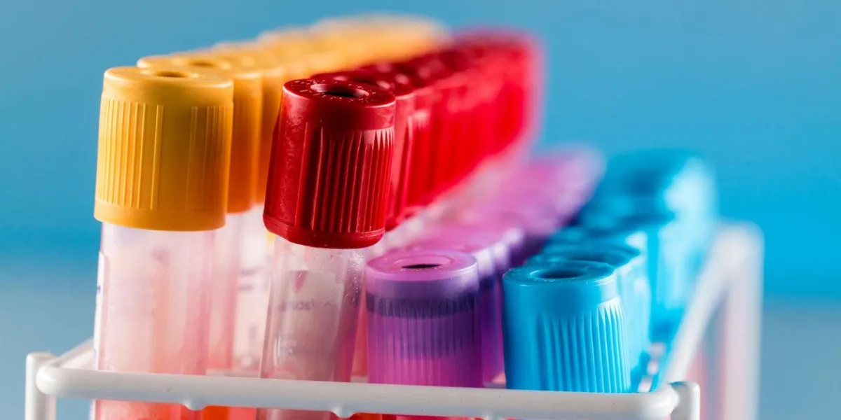test tubes with blood for medical and biological analyzes