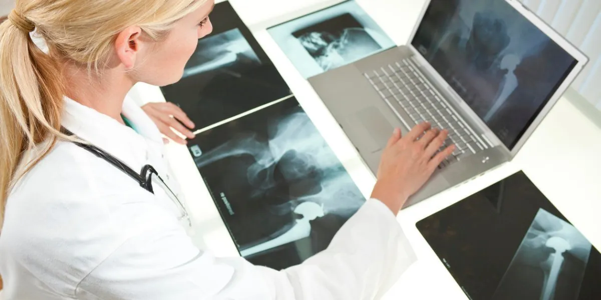 une femme blonde médecin regardant des radiographies de remplacement de la hanche et en utilisant un ordinateur portable dans un hôpital