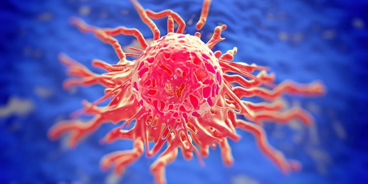 cervical cancer cell, sem of cervical carcinoma