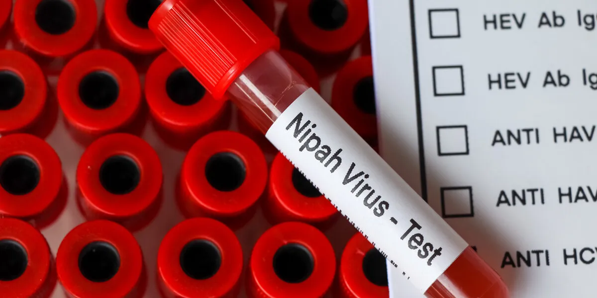 nipah virus test to look for abnormalities from blood, blood sample to analyze in the laboratory, blood in test