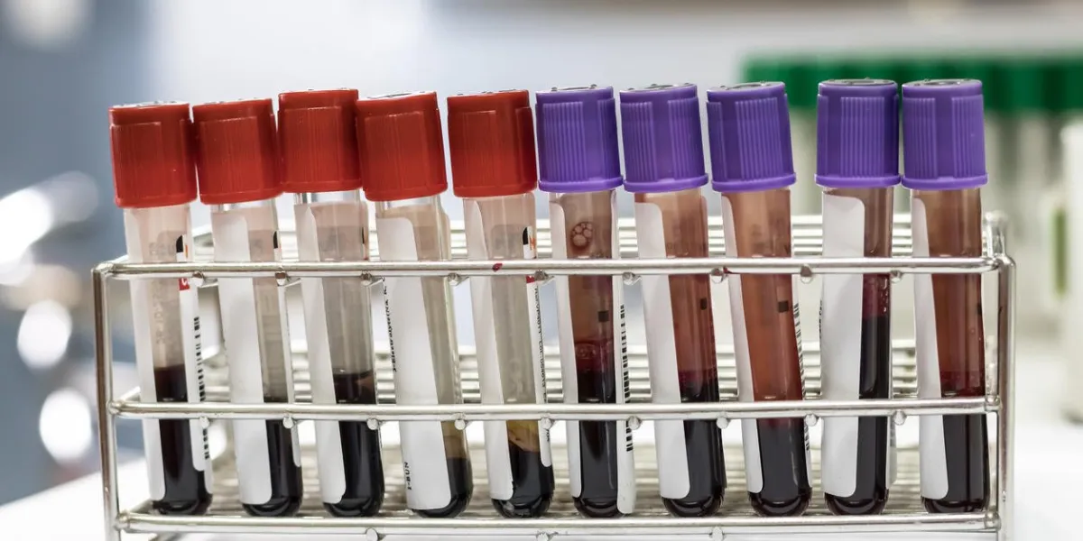 tube à essai sanguin