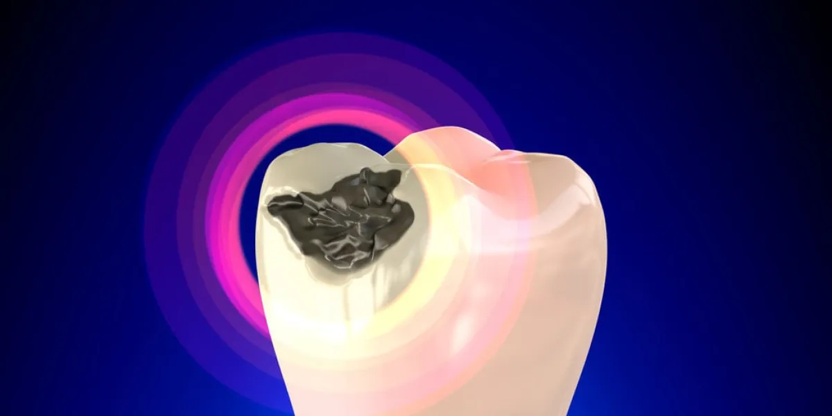 tooth molar with dental caries