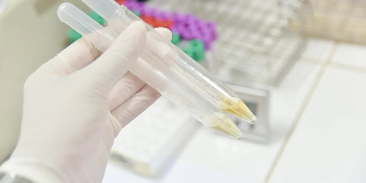 yelow urine sample in tube in lab