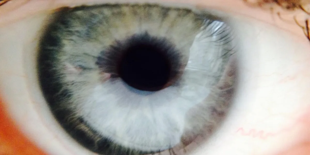 à l'intérieur de l'oeil