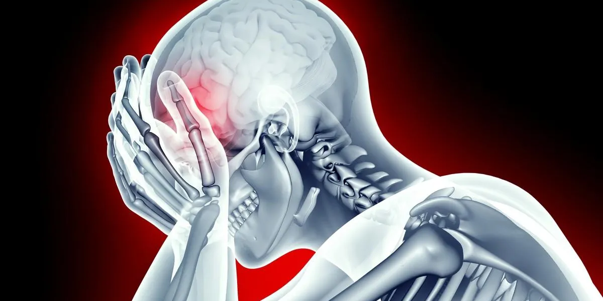 x-ray image human head with headache pain
