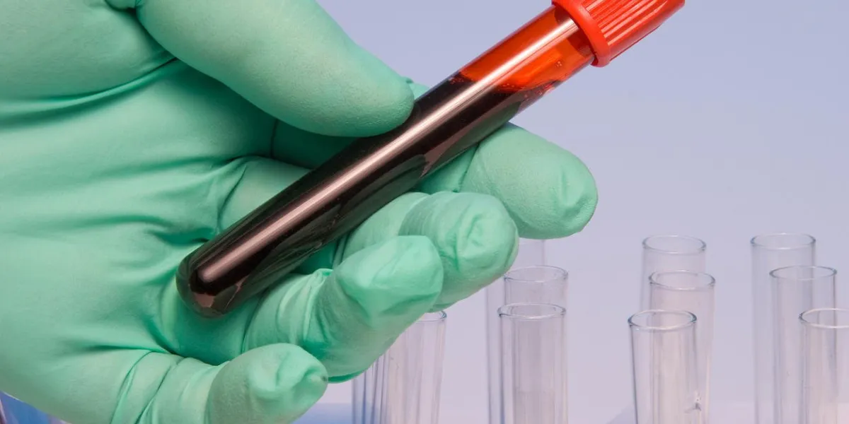 un scientifique manipulant un échantillon de sang dans un tube à essai