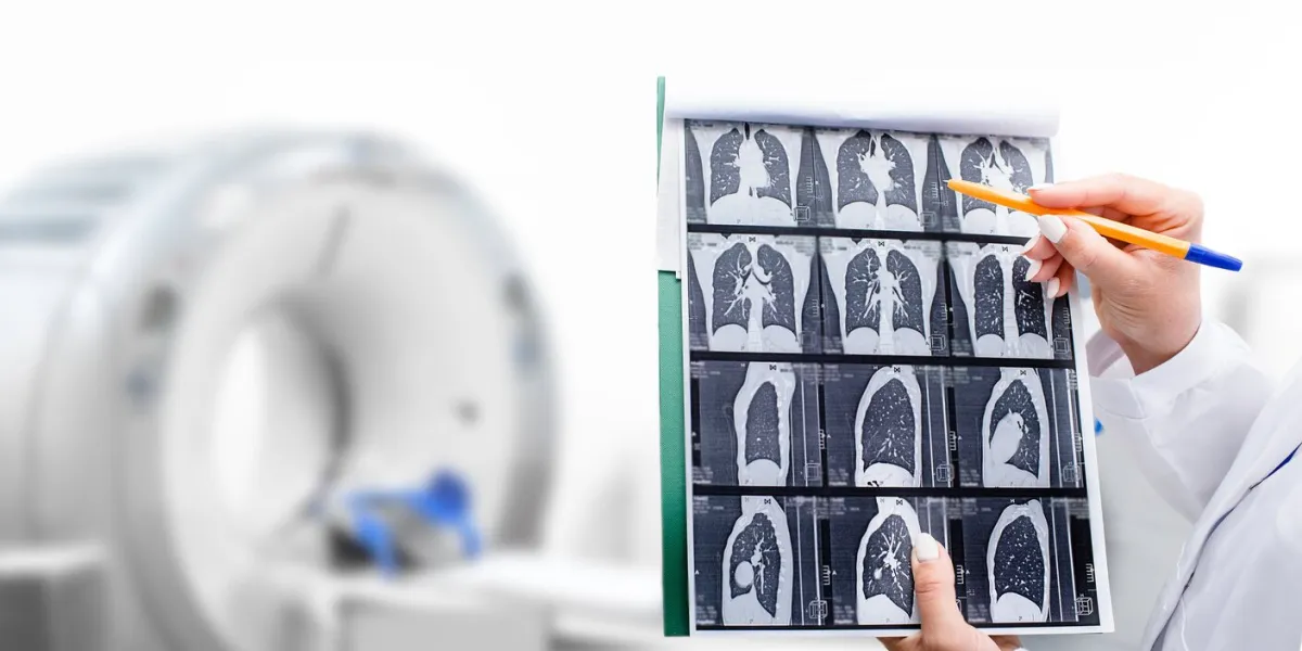 radiologist showing tomography scan of a patient's lungs over of ct machine treatment of lung diseases, pneumonia, coronavirus, covid, cancer, tuberculosis