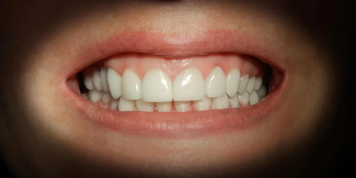 a close up of a patient's mouth at a dental clinic