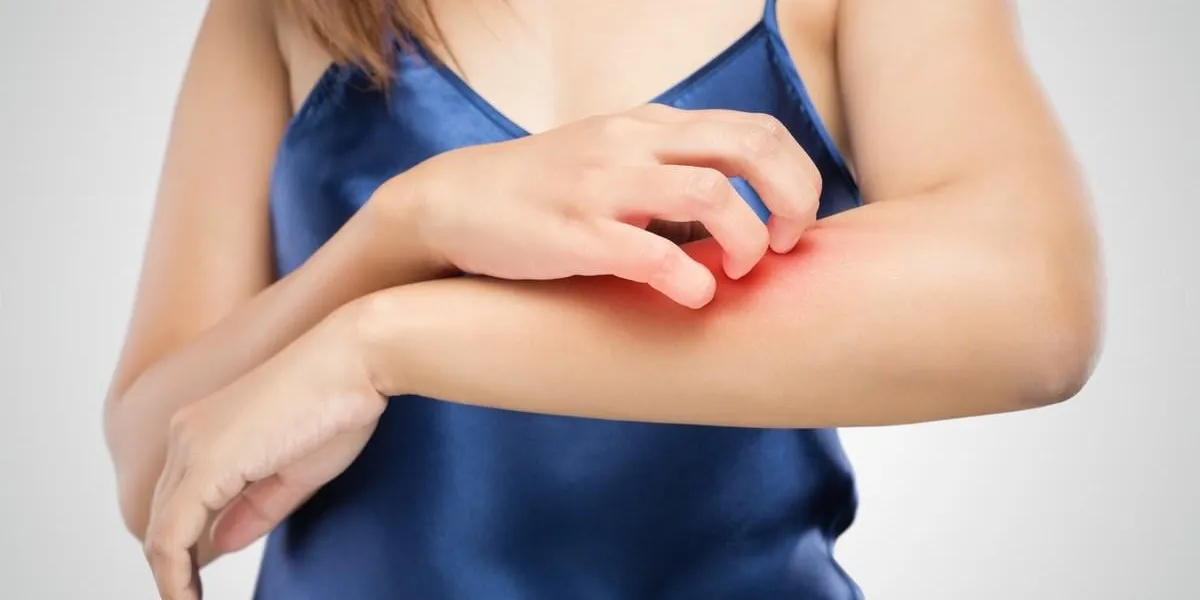 people scratch the itch with hand, arm, itching, concept with healthcare and medicine