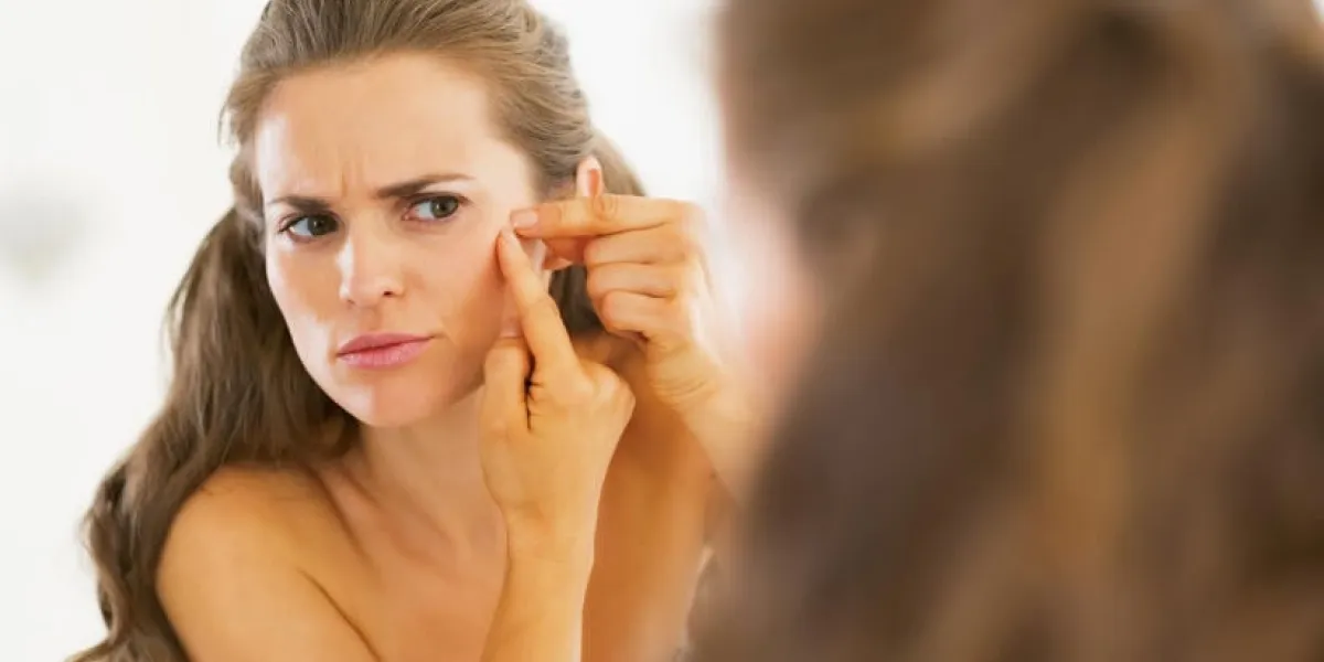 frustré jeune femme serrant l'acné