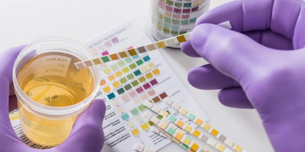 test tires in violet gloves with test chart and urine can