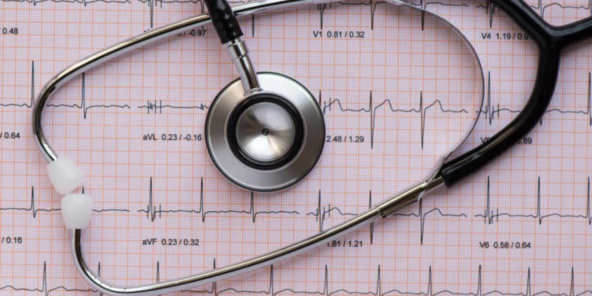 stéthoscope matériel médical recouvrant un ecg ou ekg